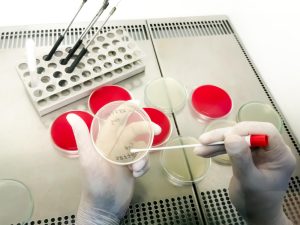 Cum se realizează procesul de recoltare a celulelor stem