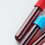 Hemoleucogramă completă ce înseamnă? Analiza detaliată a sângelui