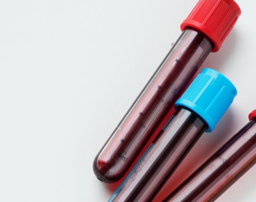 Hemoleucogramă completă ce înseamnă? Analiza detaliată a sângelui